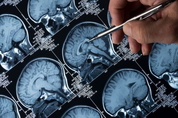 Vedci varuju umela inteligencia ti potichu prepisuje mozog a ani o tom nevies