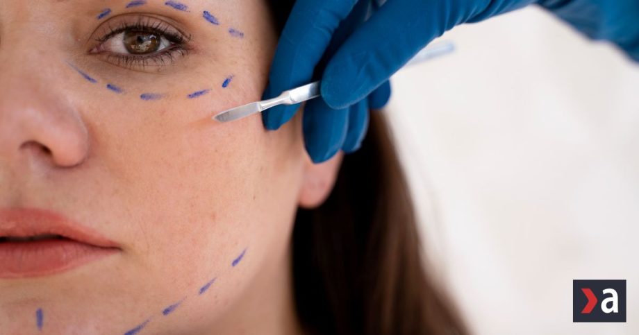 Blefaroplastika je najtrendovejsi zakrok desatrocia Lekarka Mnohe pacientky to neskor lutuju