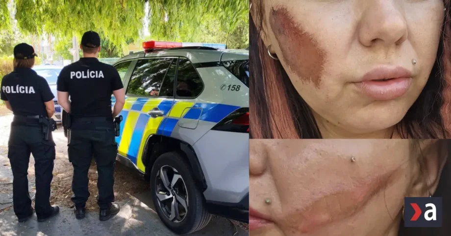 V pripade napadnutych zien z Trnavy policia zacala konat po tlaku media