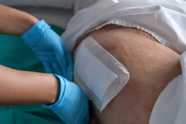 Preležaniny ako bomba: tisíce pacientov, prevencia šetrí milióny